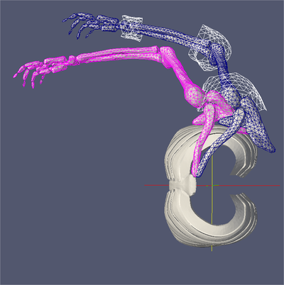 Shoulder Repositionning Shoulder Repositionning